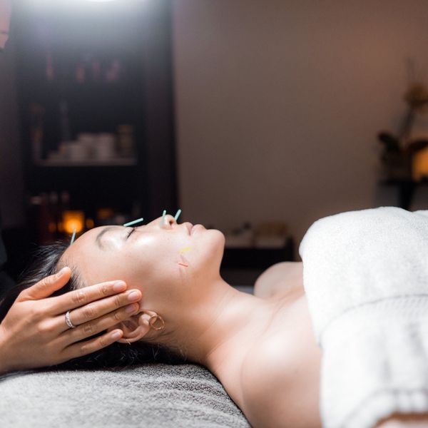 International Orange's acupuncture facial is a must—here's why